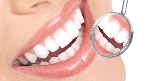 blanqueamiento-dental Farmacia Acacia en Leganés