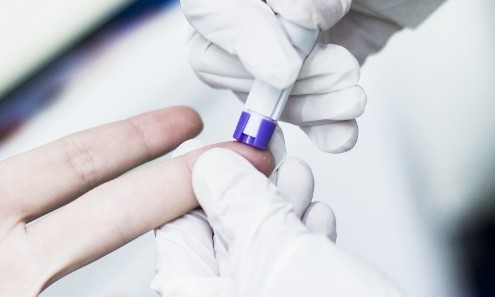 control perfil lipidico Farmacia Acacia en Leganés