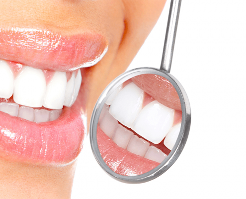 prevencion dental