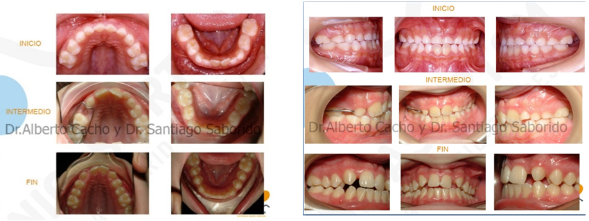 ortodoncia 1