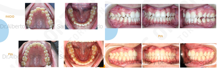 ortodoncia 2